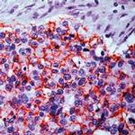 Claudin 4 Antibody in Immunohistochemistry (Paraffin) (IHC (P))