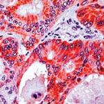 APC Antibody in Immunohistochemistry (IHC)