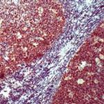 Oct-2 Antibody in Immunohistochemistry (IHC)