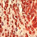 S100A4 Antibody in Immunohistochemistry (IHC)