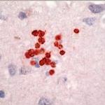 Toxoplasma Gondii Antibody in Immunohistochemistry (IHC)