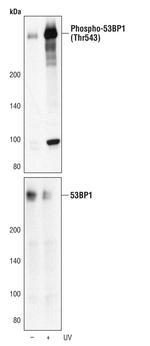 Phospho-53BP1 (Thr543) Antibody in Western Blot (WB)