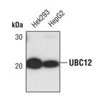 UBE2M Polyclonal Antibody