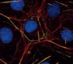 MYH10 Polyclonal Antibody