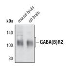GABBR2 Polyclonal Antibody