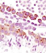PIWIL1 Antibody in Immunohistochemistry (IHC)