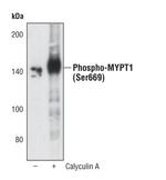 Phospho-MYPT1 (Ser668) Polyclonal Antibody