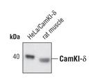 CAMK1D Polyclonal Antibody