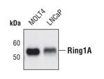 RING1 Polyclonal Antibody