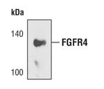 FGFR4 Polyclonal Antibody
