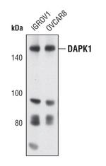 DAPK1 Polyclonal Antibody