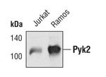 PYK2 Polyclonal Antibody