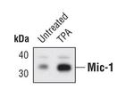 GDF15 Polyclonal Antibody