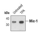 GDF15 Antibody in Western Blot (WB)