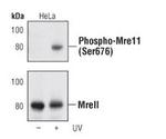 Phospho-MRE11 (Ser676) Polyclonal Antibody