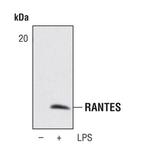 CCL5 (RANTES) Polyclonal Antibody