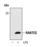 CCL5 (RANTES) Polyclonal Antibody