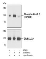 Phospho-GluR2 (Tyr876) Polyclonal Antibody