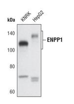 ENPP1 Polyclonal Antibody