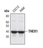 ERI1 Polyclonal Antibody