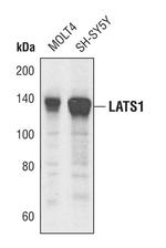 LATS1 Polyclonal Antibody
