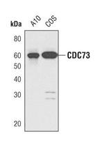 Cdc73 Polyclonal Antibody