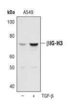 TGFBI Antibody in Western Blot (WB)