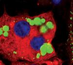 HSL Polyclonal Antibody