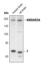NMDAR2A Polyclonal Antibody