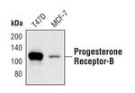 Progesterone Receptor Antibody in Western Blot (WB)