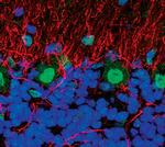 APE1 Antibody in Immunohistochemistry (IHC)
