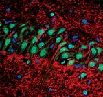 APE1 Antibody in Immunohistochemistry (IHC)