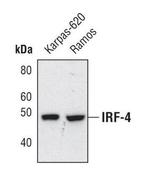 IRF4 Polyclonal Antibody