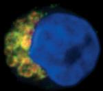 MAVS Polyclonal Antibody