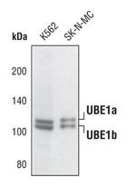 UBE1 Isoform A/B Polyclonal Antibody