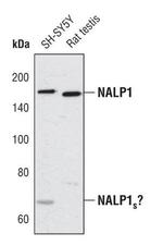 NALP1 Antibody in Western Blot (WB)