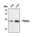 PSME1 Polyclonal Antibody