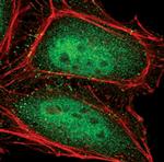 PSMA5 Polyclonal Antibody