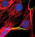 alpha Actinin 1 Polyclonal Antibody