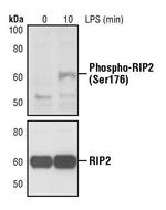 Phospho-RIP2 (Ser176) Antibody in Western Blot (WB)
