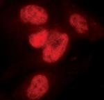 SnoN Antibody in Immunocytochemistry (ICC/IF)