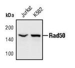 RAD50 Polyclonal Antibody