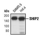 SHIP2 Polyclonal Antibody