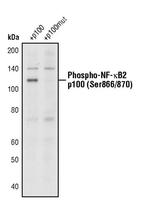Phospho-NFkB p100 (Ser866, Ser870) Polyclonal Antibody