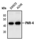 PAR4 Antibody in Western Blot (WB)