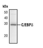 C/EBP delta Polyclonal Antibody