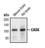 CASK Polyclonal Antibody