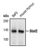 STAT2 Polyclonal Antibody