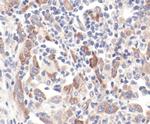 GBL Polyclonal Antibody