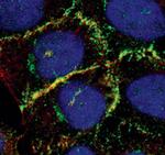 Catenin alpha-1 Polyclonal Antibody